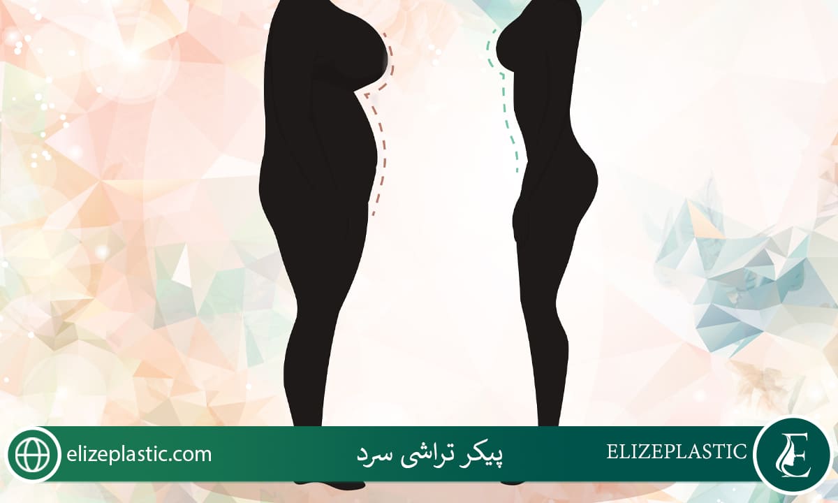 پیکر تراشی سرد